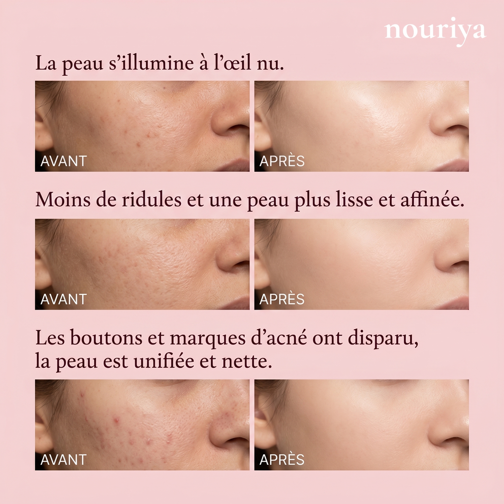 Nouriya LED Glow Mask