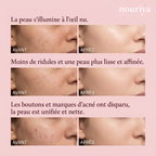 Nouriya LED Glow Mask