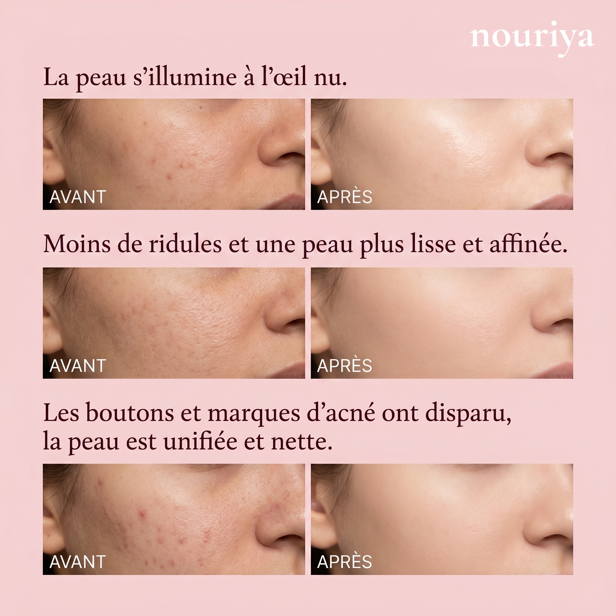 Nouriya LED Glow Mask